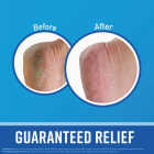 O'Keeffe's Healthy Feet 3.2 Oz. Jar Cream Lotion Image 2