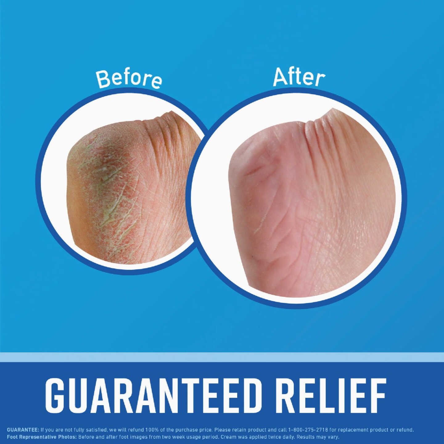 O'Keeffe's Healthy Feet 3.2 Oz. Jar Cream Lotion Image 2